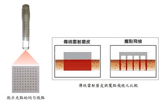 飛梭3